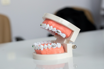 Ultimate Guide to Braces for Kids