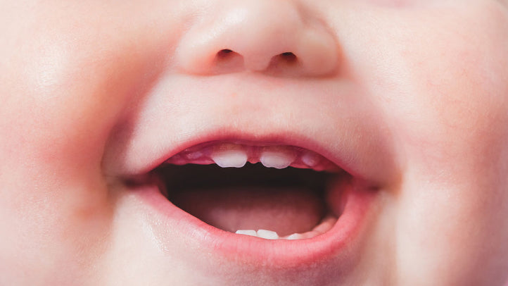 Cavities in Baby Teeth 